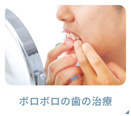 ボロボロの歯の治療